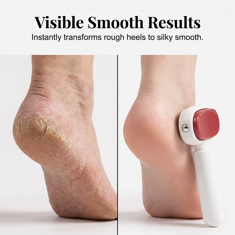 🦶 Smooth Heels, Ready for Sandals – Double-Sided Foot Scraper with Coarse & Fine Sides. 50% Off. UK Stock